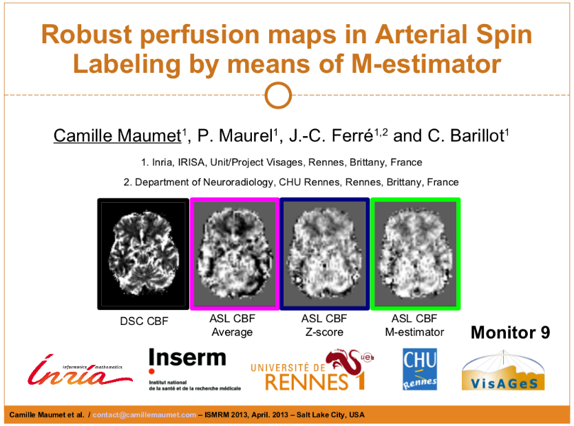 ISMRM 2013